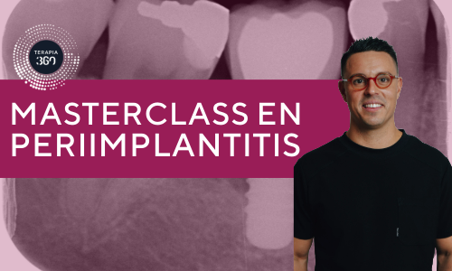masterclass en periimplantitis