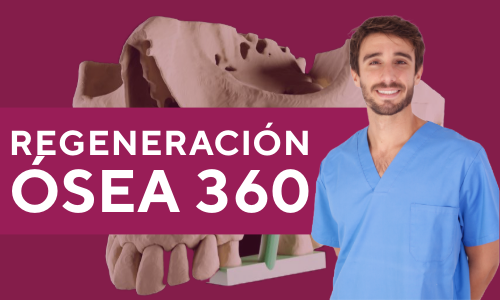 Curso de regeneración ósea