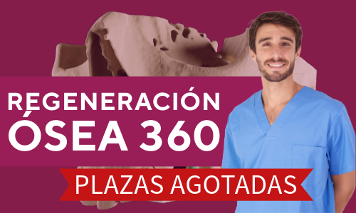 Curso de regeneración ósea plazas agotadas