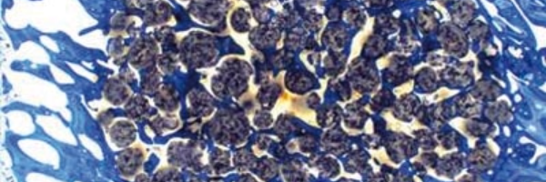 biomateriales en cirugía regenerativa