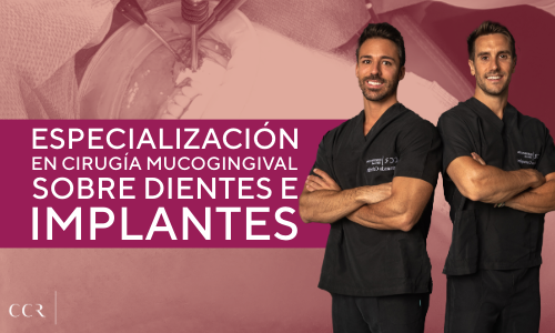 Cirugía mucogingival