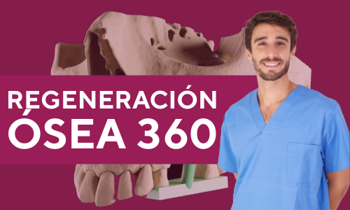 Cómo ganar seguridad al empezar en cirugía regenerativa 1 cirugía regenerativa